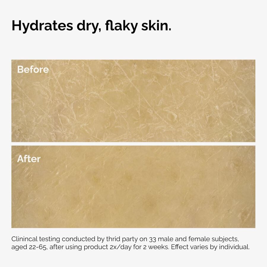 the-body-care-collection-l4 ord-natural-moisturizing-factors-inulin-body-before-after-graphic-02.jpg