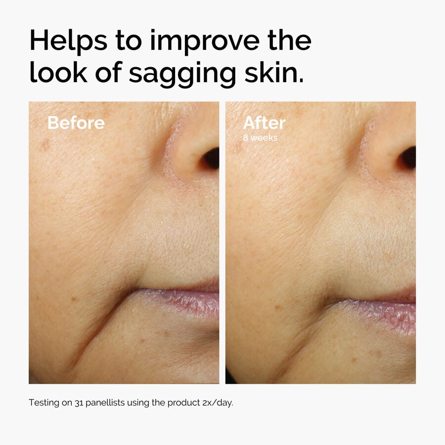 caffeine-3-escin-1-face-serum-b0 ord-caffeine-3pct-escin-1pct-face-serum-before-after-sagging.jpg