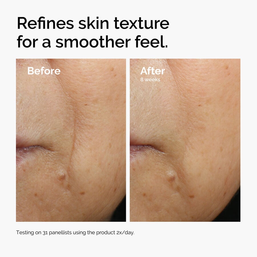 caffeine-3-escin-1-face-serum-b0 ord-caffeine-3pct-escin-1pct-face-serum-before-after-texture.jpg