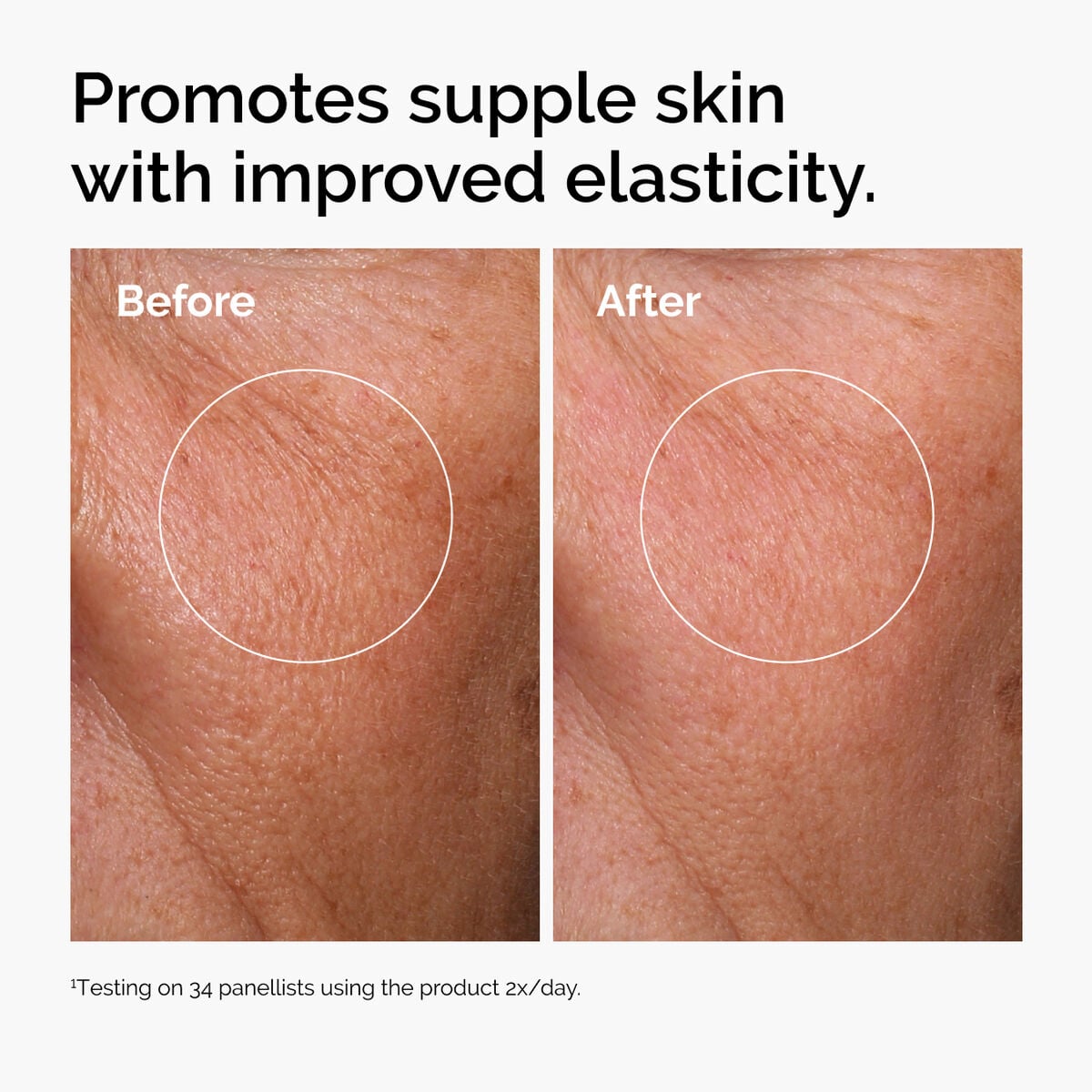 hyaluronic-acid-2-b5-with-ceramides-o0 ord-hyaluronic-acid-2pct-b5-hydrating-serum-before-after-elasticity.jpg