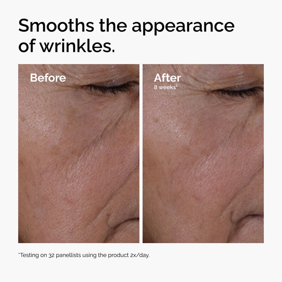 multi-peptide-ha-serum-l1 ord-multi-peptide-ha-serum-wrinkles-before-after.jpg