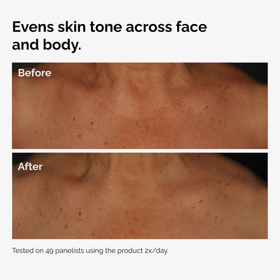 the-body-care-collection-l4 ord-niacinamide-face-body-serum-before-after-even-tone-graphic.jpg