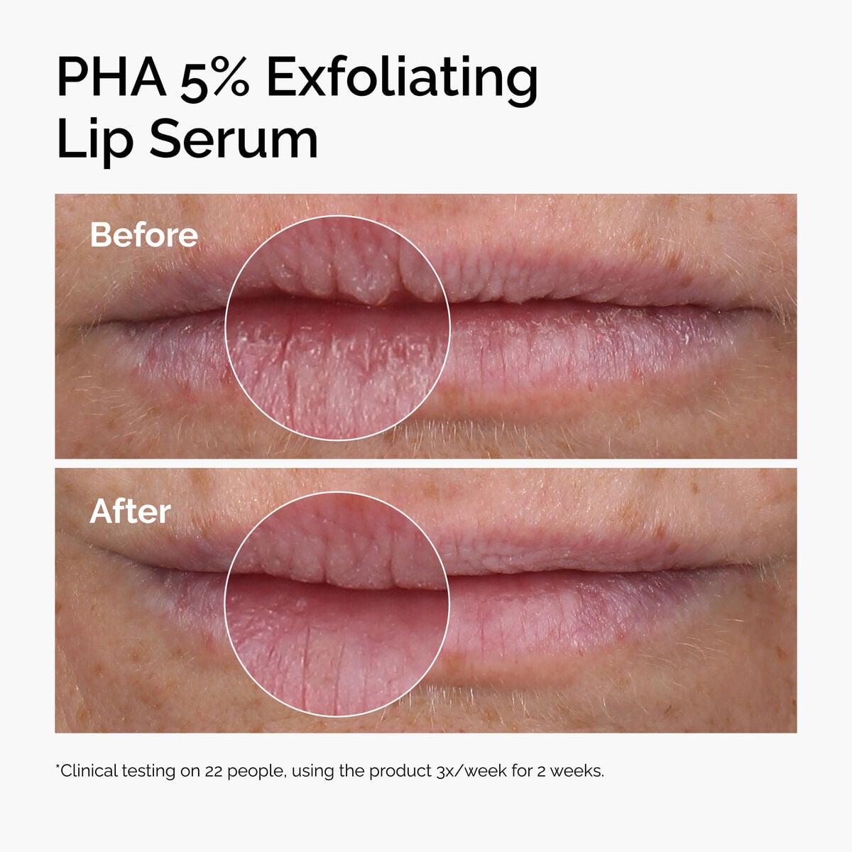 pha-5-exfoliating-lip-serum-y6 ord-pha-5pct-lip-exfoliating-serum-before-after.jpg