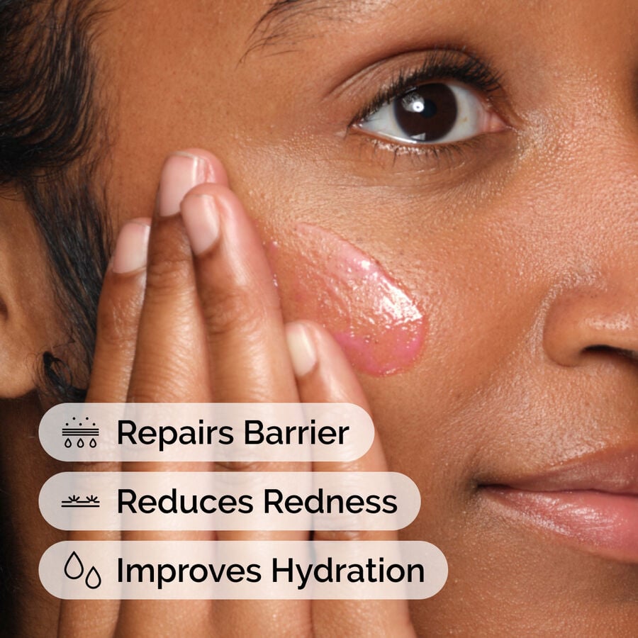 soothing-and-barrier-support-serum-d9 ord-soothing-barrier-support-serum-model-application-with-benefits.jpg