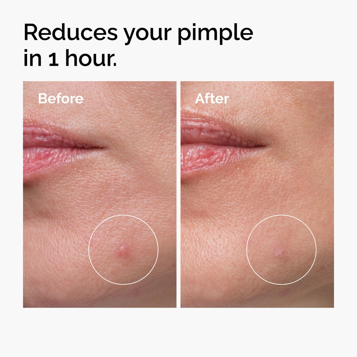 sulfur-10-powder-to-cream-concentrate-p0 ord-sulfur-10pct-powder-to-cream-concentrate-before-after-NA.jpg